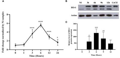 Leishmania Parasites Differently Regulate Antioxidant Genes in Macrophages Derived From Resistant and Susceptible Mice